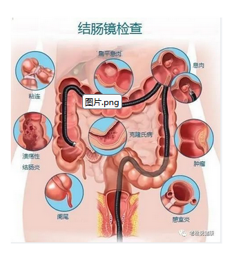 图片.png